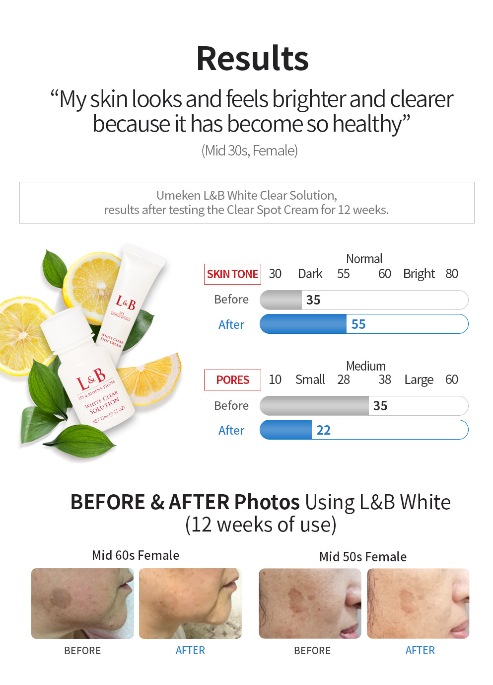 LNB white solution10
