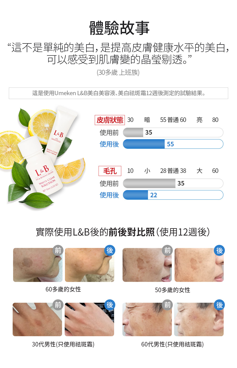 LNB white spot cream4
